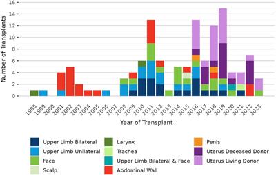 Impact of removing OPTN region from vascularized composite allograft allocation